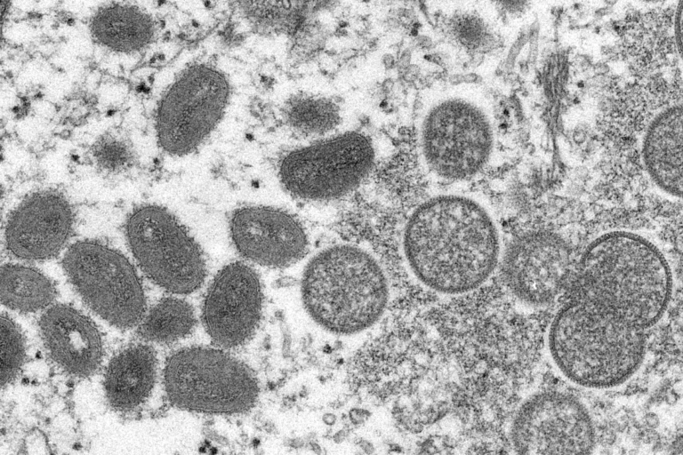 US confirms first monkeypox death